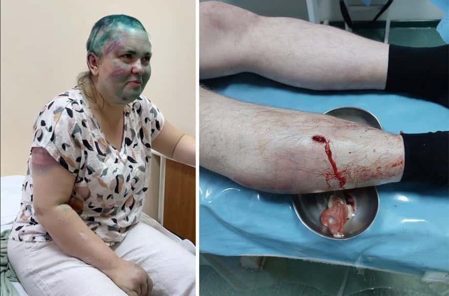“They knew what they wanted and what their limits were”: Elena Milashina and Alexander Nemov recount being beaten and forced to eat soil