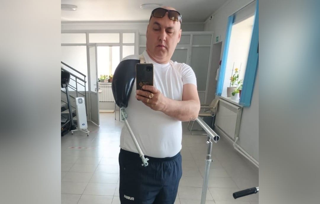 Потерявшему руку на войне в Украине россиянину дали металлическую палку вместо протеза — «Важные истории»